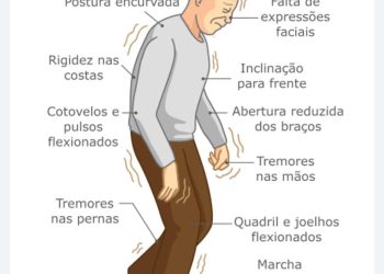 Dr. Mário Sérgio fala sobre o Mal de Parkinson