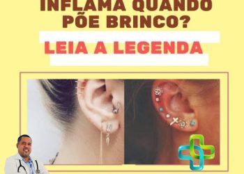 Dr. Mário Sérgio fala sobre inflamação na orelha ao usar brincos
