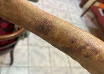 Homem é preso após agredir, ameaçar e extorquir a própria mãe idosa em Nova Venécia